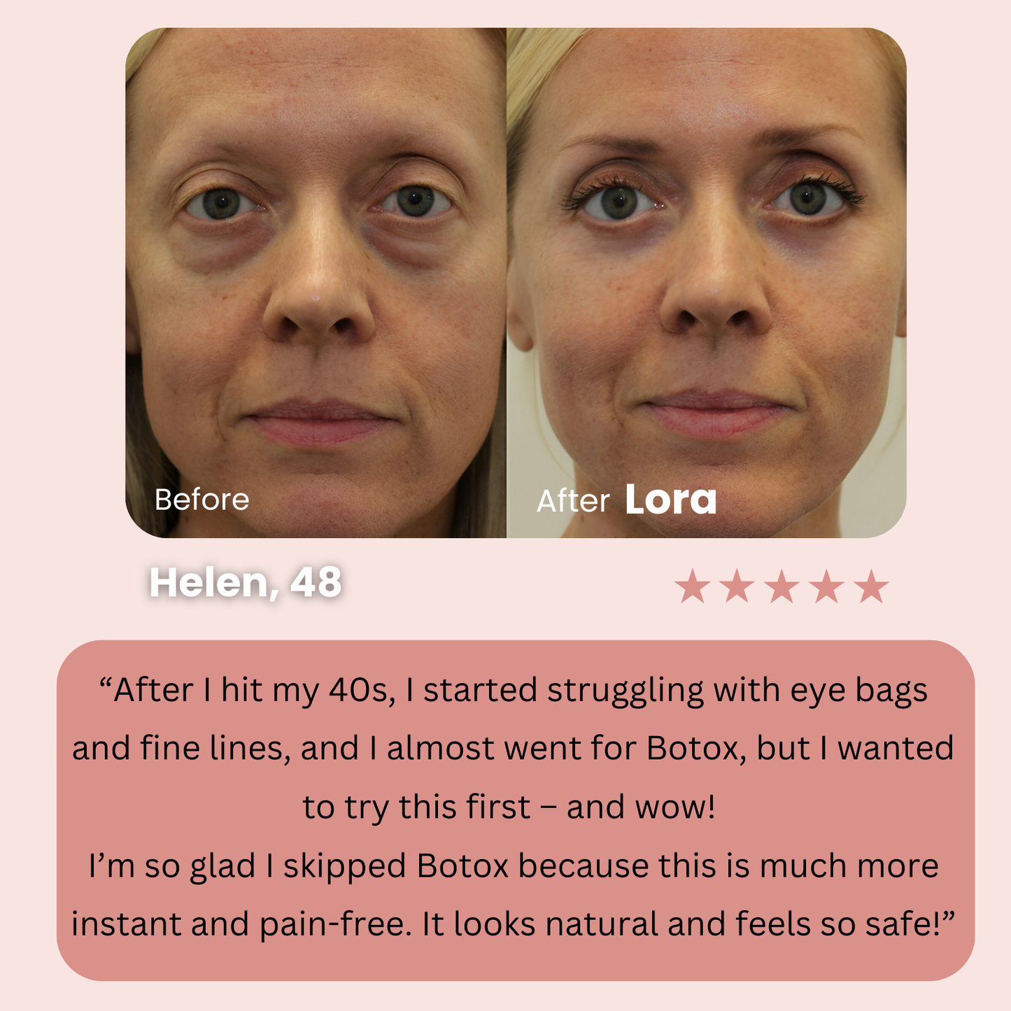 Instant Lora Face Tightener